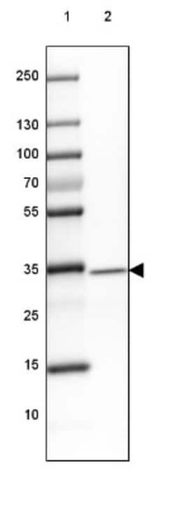 GDPD3 Antibody, Novus Biologicals:Antibodies:Primary Antibodies
